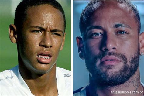 neymar antes e depois